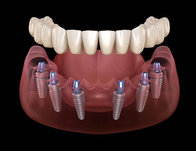 Teeth Whitening In Gandhinagar