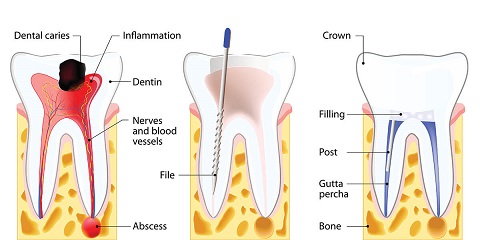 " Best Gum Surgeries In Gandhinagar"