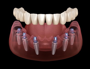 orthodentist in gandhinagar