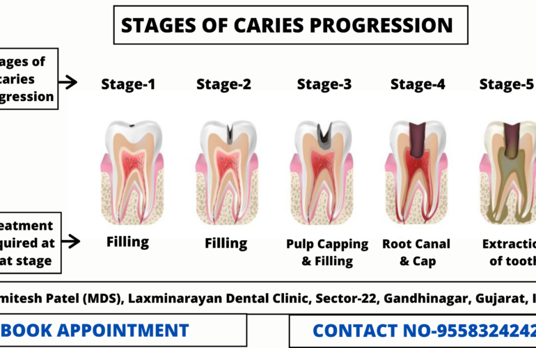 Best Dentist In Gandhinagar