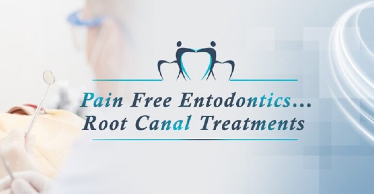 Root Canal Treatment in India