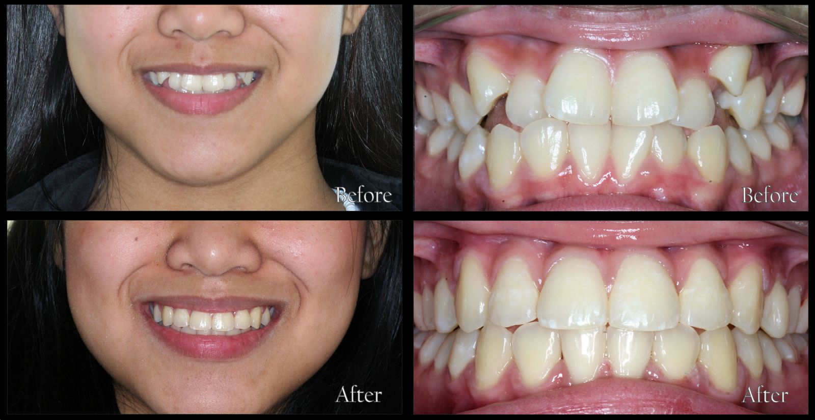 braces specialist in Gandhinagar