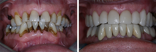 Best Cosmetic Dentistry in Gandhinagar