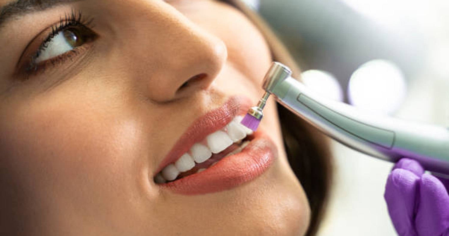 Teeth Cleaning in Randesan